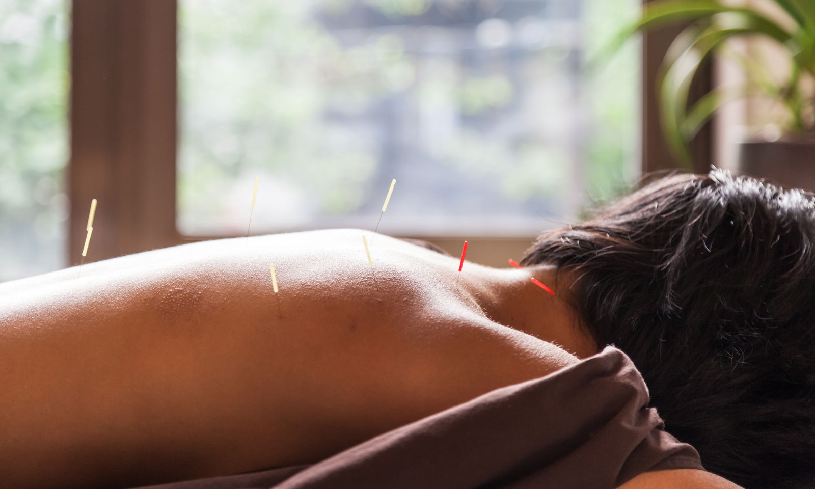 Acupuncture icon