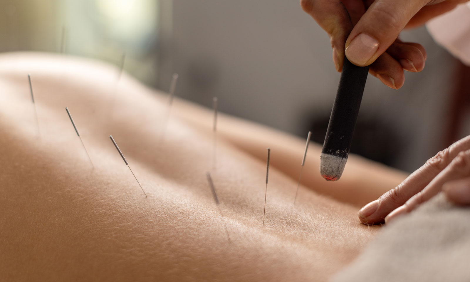 Infertility Acupuncture Treatment icon